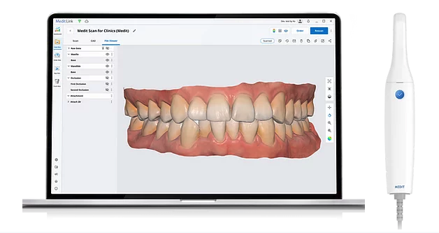 Intra Oral Scanner